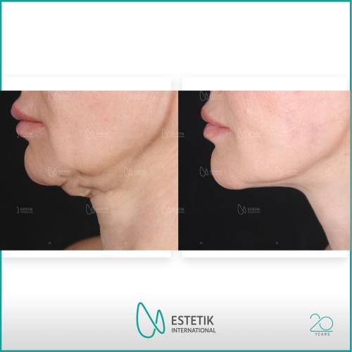 Before after photos of our patients 2